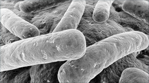 <span style="font-weight: bold;">Дезинфекция </span>